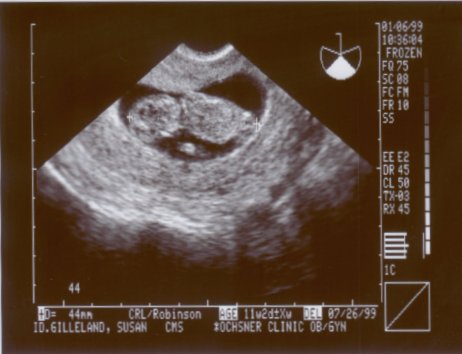 Jan 6 Minnow's 1st pic